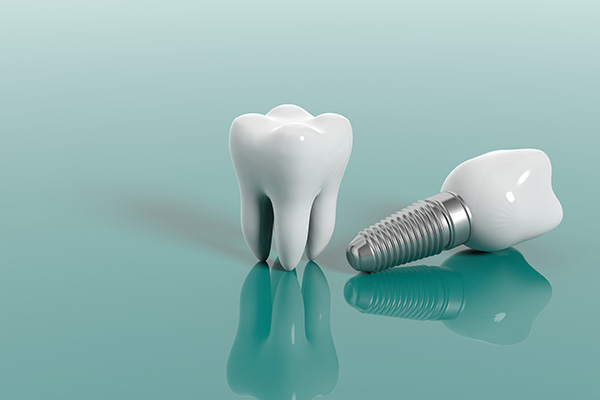 Cosmetic Dental Services Options With Implants