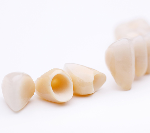 Edina Dental Crowns and Dental Bridges