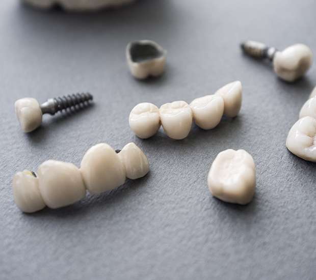 Edina The Difference Between Dental Implants and Mini Dental Implants