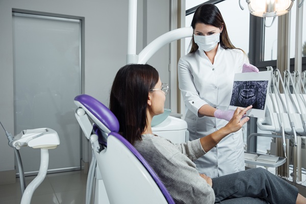 Root Canal Complications: Important Things To Know
